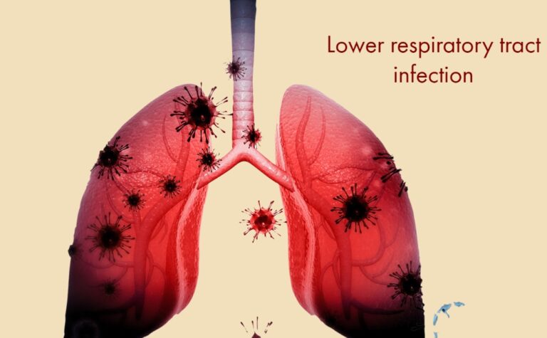 Top 10 Causes of Death in Humans around the World 2023